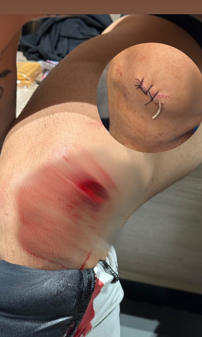 马赛俱乐部球衣